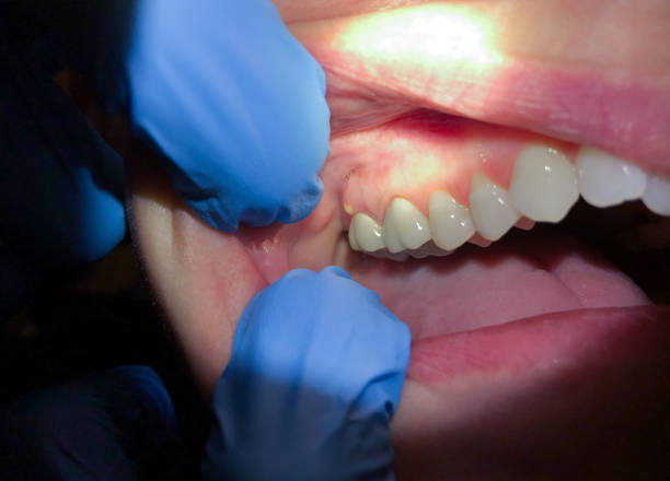 Best Urgent Dental Care for Toothache in Hartford, MI